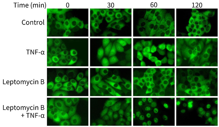 EGFP-p65 HeLa Cells (EGFP-p65 HeLa细胞)(C8001)