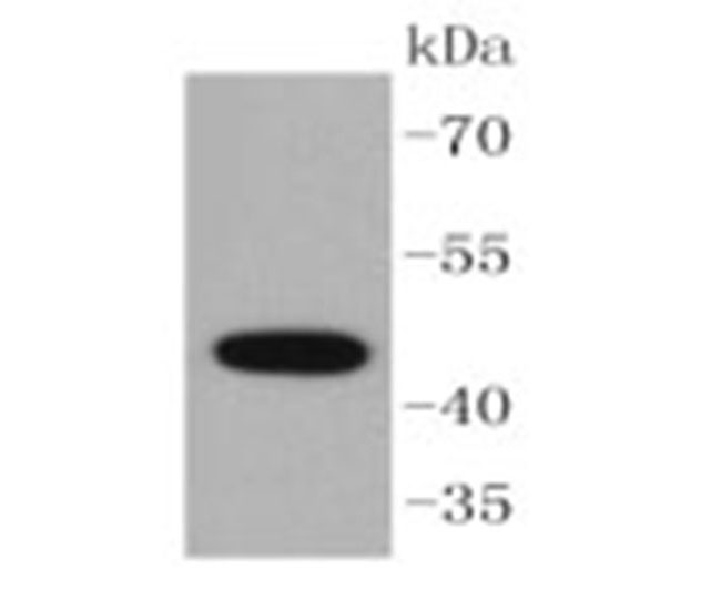 Cytokeratin 15 Rabbit mAb(Cytokeratin 15兔单抗)(AF1798)