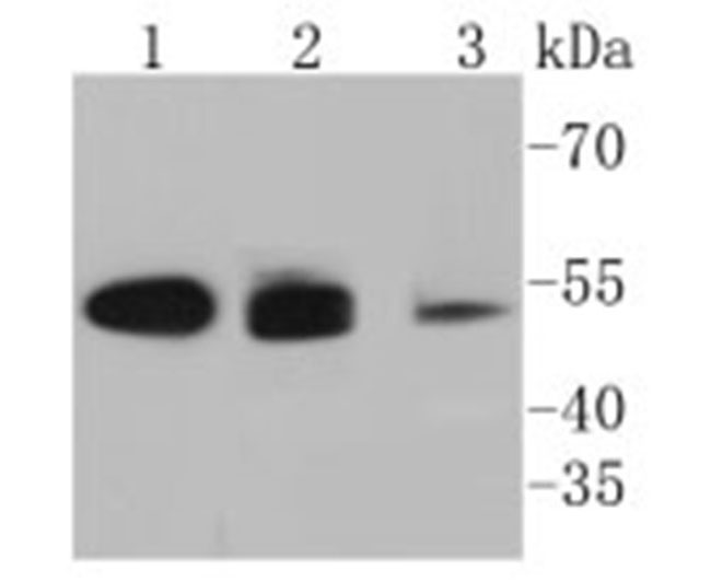 Cytokeratin 8+18 Rabbit mAb(Cytokeratin 8+18兔单抗)(AF1618)