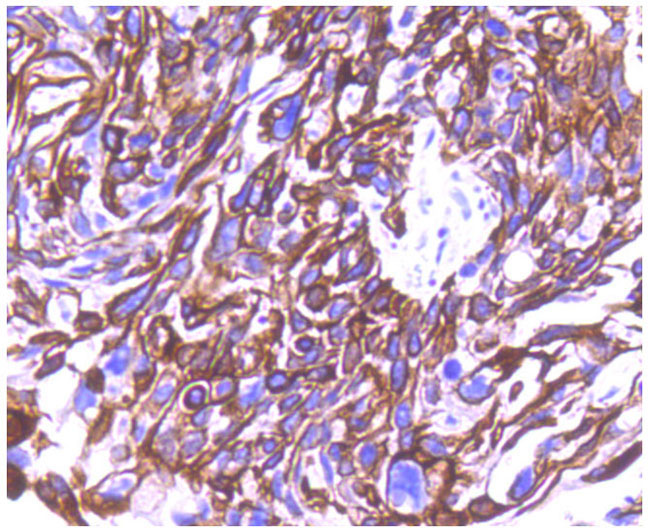 Cytokeratin 8+18 Rabbit mAb(Cytokeratin 8+18兔单抗)(AF1618)