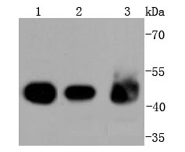 Cytokeratin 18 Rabbit mAb(Cytokeratin 18兔单抗)(AF1285)