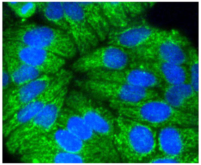 Cytokeratin 17 Rabbit mAb(Cytokeratin 17兔单抗)(AF1084)