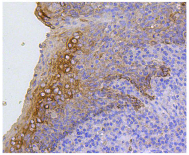 Cytokeratin 17 Rabbit mAb(Cytokeratin 17兔单抗)(AF1084)