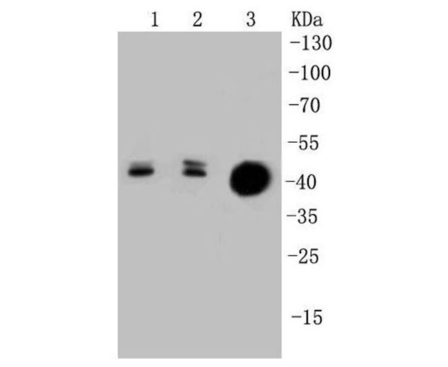Cytokeratin 20 Rabbit mAb(Cytokeratin 20兔单抗)(AF1012)