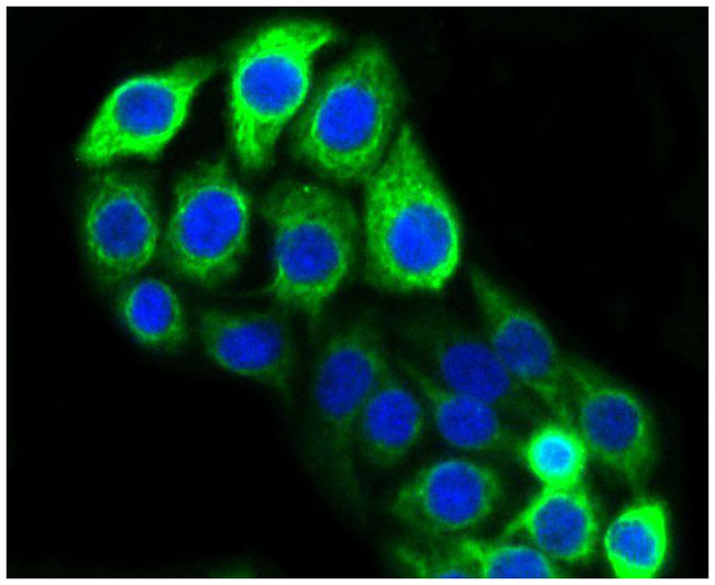 Cytokeratin 20 Rabbit mAb(Cytokeratin 20兔单抗)(AF1012)