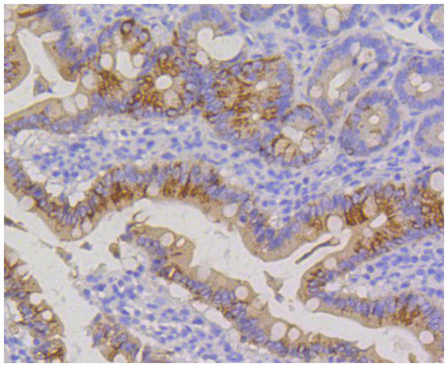 Cytokeratin 20 Rabbit mAb(Cytokeratin 20兔单抗)(AF1012)