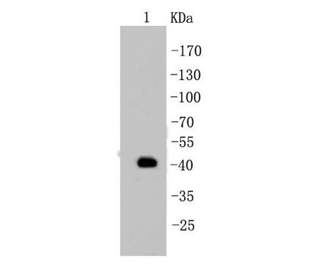 Cytokeratin 19 Rabbit mAb(Cytokeratin 19兔单抗)(AF1006)