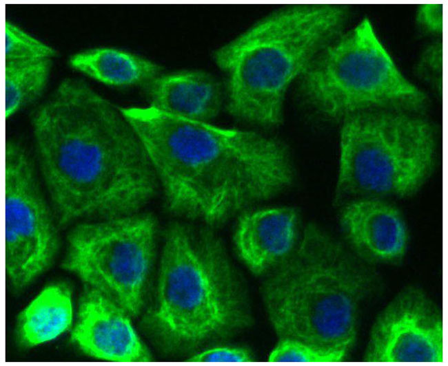 Cytokeratin 19 Rabbit mAb(Cytokeratin 19兔单抗)(AF1006)