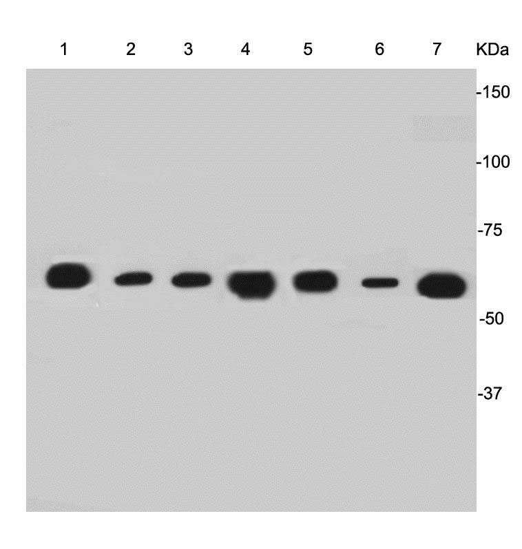 Cytokeratin-7 Mouse mAb(Cytokeratin-7小鼠单抗)(AF0129)