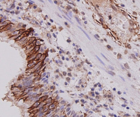 Cytokeratin-7 Mouse mAb(Cytokeratin-7小鼠单抗)(AF0129)