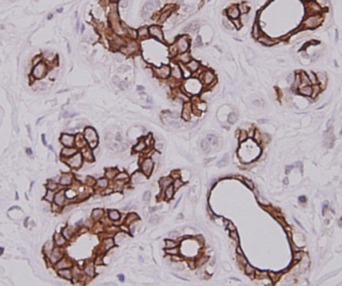 Cytokeratin-7 Mouse mAb(Cytokeratin-7小鼠单抗)(AF0129)