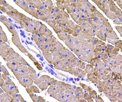 Cardiac Troponin T Rabbit pAb(Cardiac Troponin T兔多抗)(AF0078)
