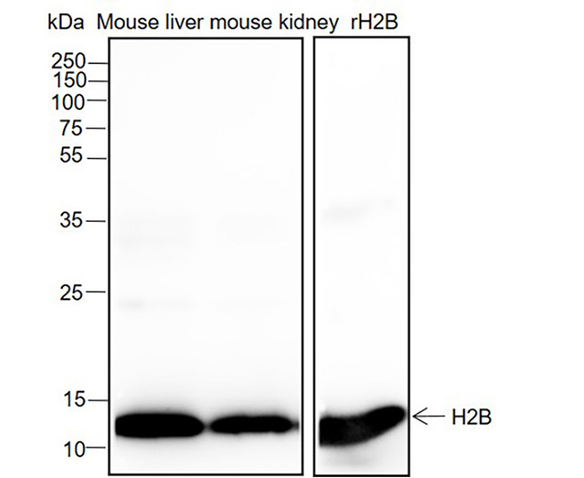 Histone H2B Rabbit Monoclonal Antibody (Histone H2B兔单抗)(AG0164)