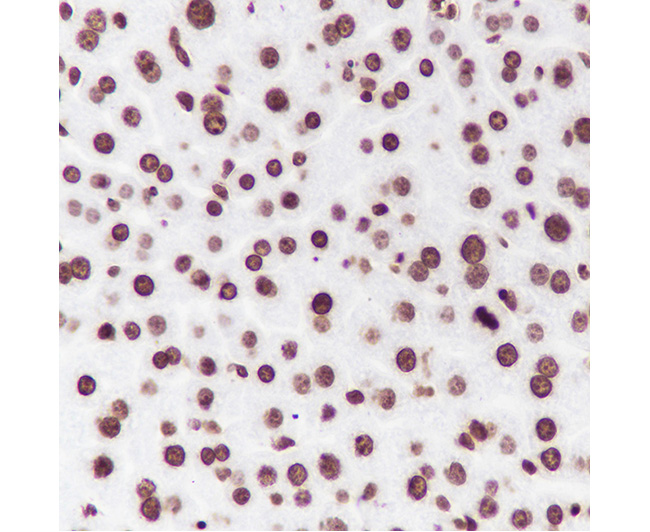 Histone H2B Rabbit Monoclonal Antibody (Histone H2B兔单抗)(AG0164)