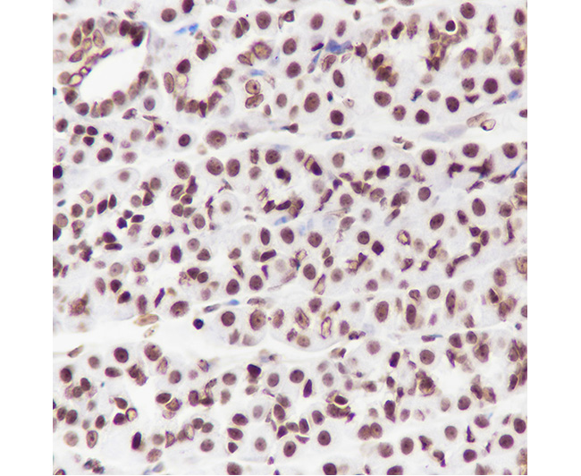 Histone H2B Rabbit Monoclonal Antibody (Histone H2B兔单抗)(AG0164)