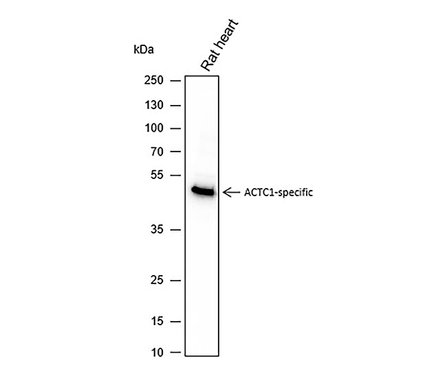 α-Cardiac Actin/ACTC1 Mouse Monoclonal Antibody (ACTC1小鼠单抗)(AG0150)