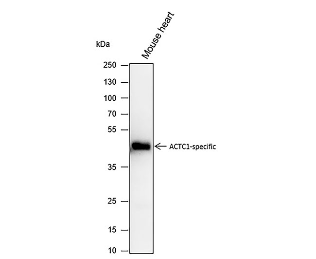 α-Cardiac Actin/ACTC1 Mouse Monoclonal Antibody (ACTC1小鼠单抗)(AG0150)