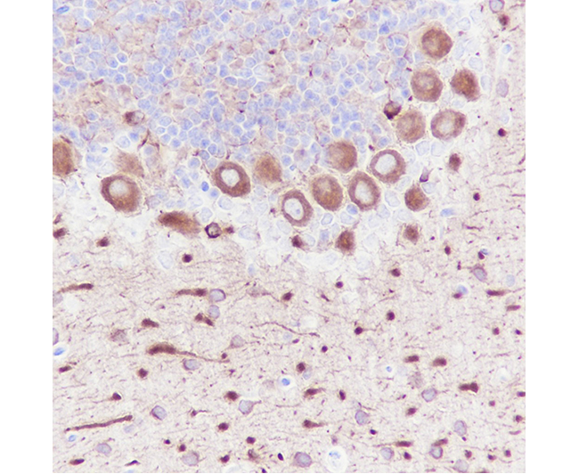 Neuron-specific beta-III Tubulin Mouse Monoclonal Antibody (Tuj1小鼠单抗)(AG0147)