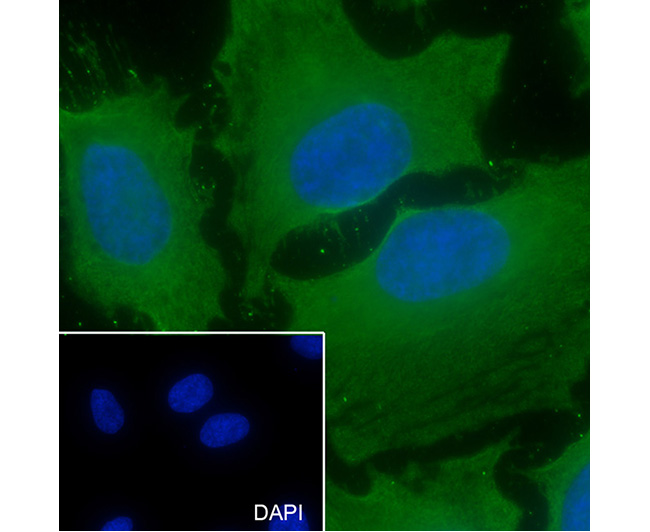 GAPDH Rabbit Monoclonal Antibody (GAPDH兔单抗)(AG0122)