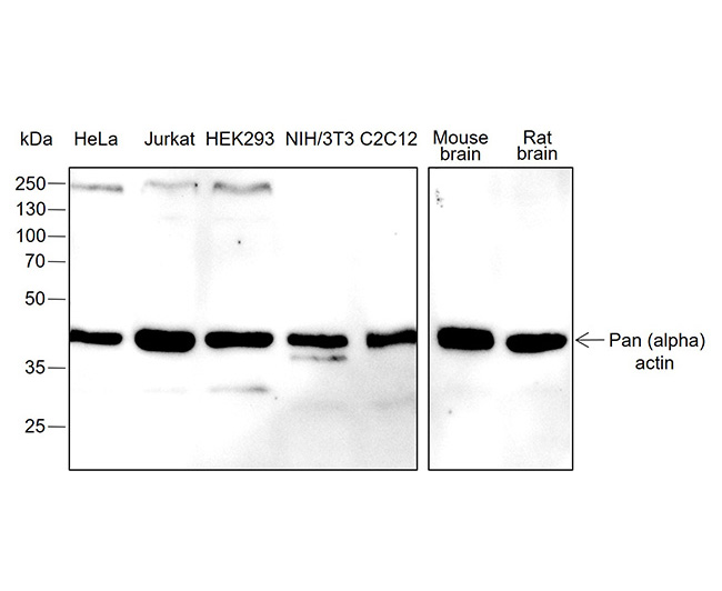 Pan-Actin Rabbit Monoclonal Antibody (Pan-Actin兔单抗)(AG0115)