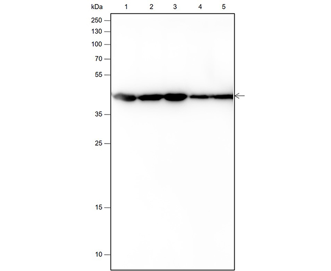 α-Smooth Muscle Actin Rabbit Monoclonal Antibody (α-SMA兔单抗)(AG0101)