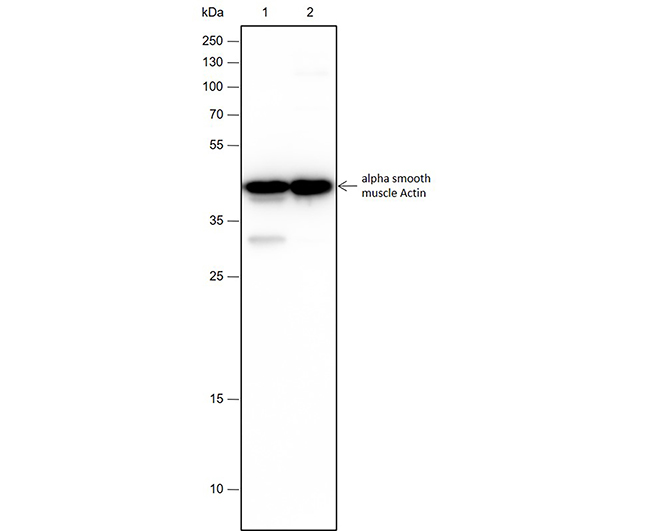 α-Smooth Muscle Actin Rabbit Monoclonal Antibody (α-SMA兔单抗)(AG0101)