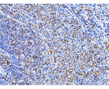 β-Actin Mouse Monoclonal Antibody(β-Actin 小鼠单抗)(AF5001)