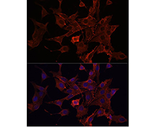 β-Actin Mouse Monoclonal Antibody(β-Actin 小鼠单抗)(AF5001)
