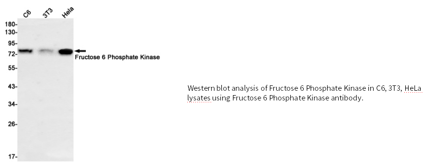 果糖6磷酸激酶兔单克隆抗体 Fructose 6 Phosphate Kinase Rabbit mAb(兔单抗)