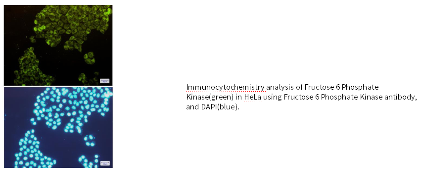 果糖6磷酸激酶兔单克隆抗体 Fructose 6 Phosphate Kinase Rabbit mAb(兔单抗)