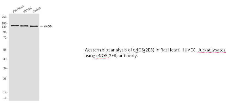 eNOS小鼠单克隆抗体 eNOS Mouse mAb(小鼠单抗)