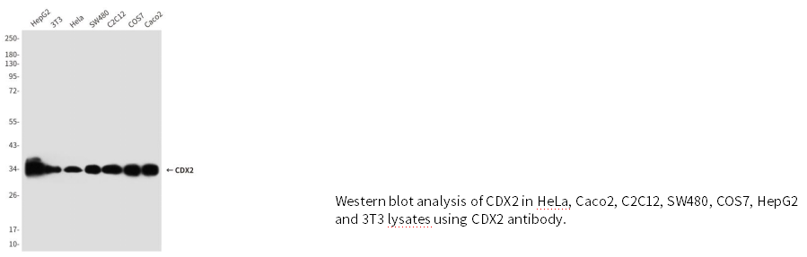 CDX2小鼠单克隆抗体 CDX2 Mouse mAb(小鼠单抗)