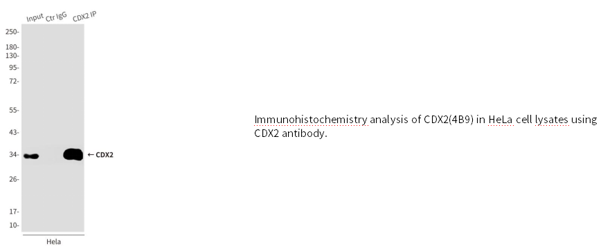 CDX2小鼠单克隆抗体 CDX2 Mouse mAb(小鼠单抗)