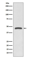 TSG101兔多克隆抗体 TSG101 Rabbit pAb