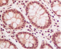 泛素兔多克隆抗体 Ubiquitin Rabbit pAb