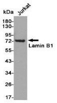 Lamin B1小鼠单克隆抗体 Lamin B1 Mouse mAb