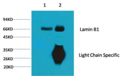 Lamin B1小鼠单克隆抗体 Lamin B1 Mouse mAb
