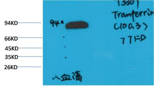 转铁蛋白小鼠单克隆抗体 Transferrin Mouse mAb