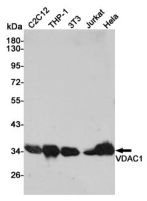 VDAC1兔多克隆抗体 VDAC1 Rabbit pAb