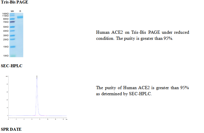 重组人ACE2/ACEH(His标签) 血管紧张素I转换酶